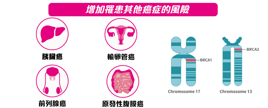 BRCA 基因與乳癌卵巢癌的風險